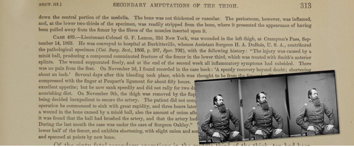 Case 489. – Lieutenant-Colonel G.F. Lamon