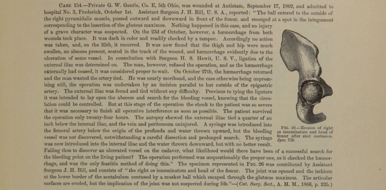 Case 154. – Private G.W. Gentle